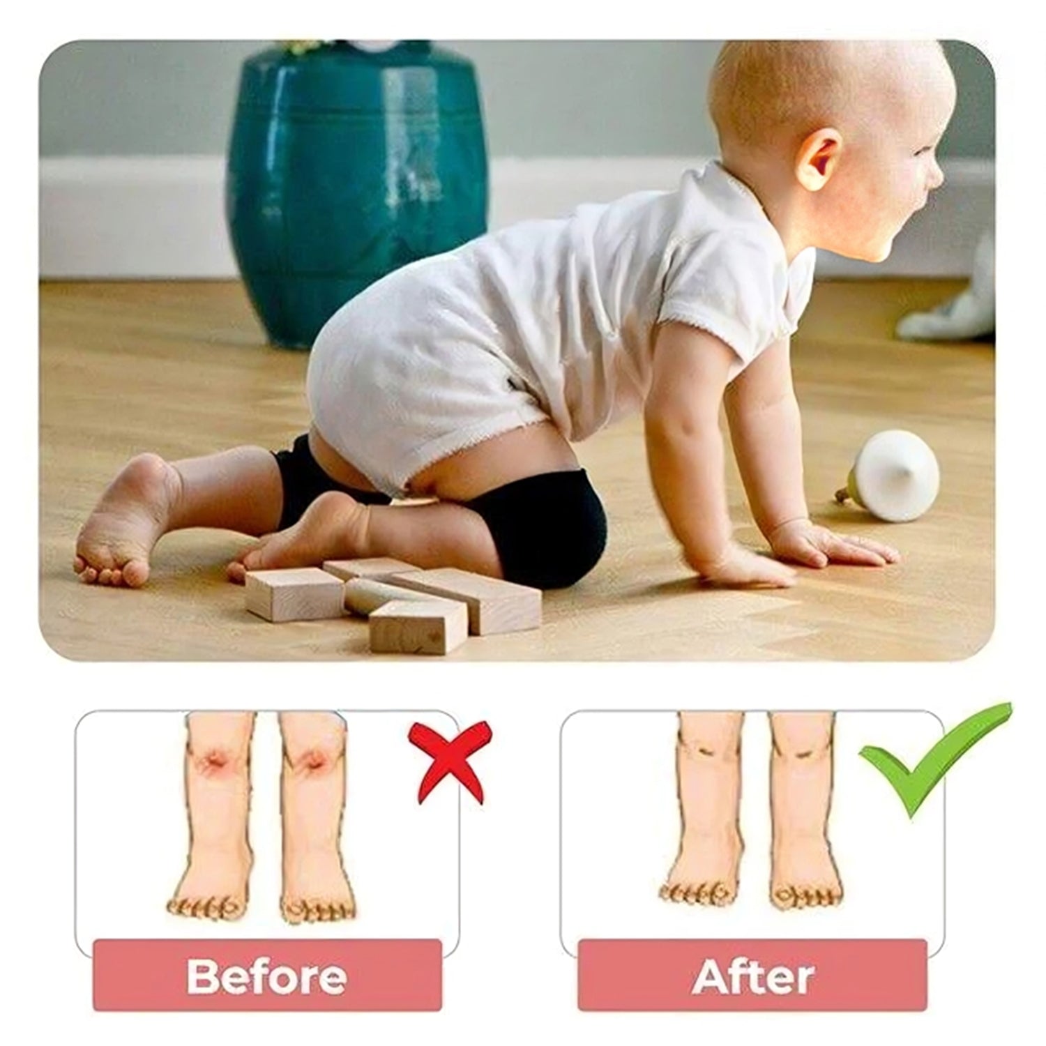 1 Pairs Baby Knee Pads for Crawling (1 Pair / 6 Cm) 1 Pairs Baby Knee Pads for Crawling (1 Pair / 6 Cm)